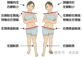 科普 | 走路像是踩高跷？注意可能是长短腿