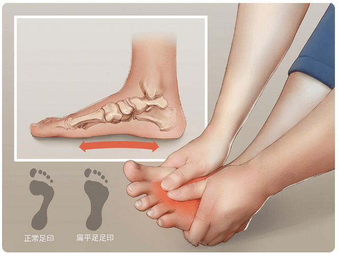 Popular Science | Why are people with flat feet unfit for military service? Don't let flat feet stand in the way of your child's dream of becoming a soldier!