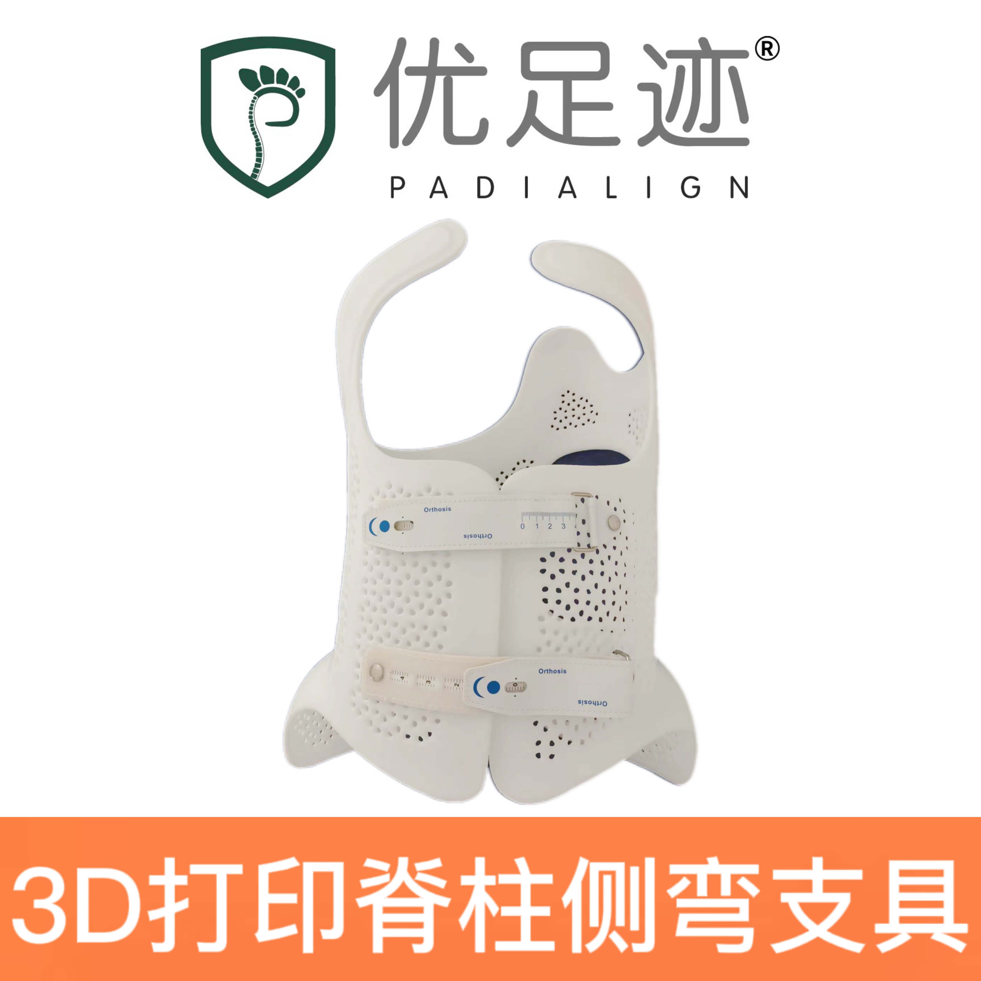 3D Printed Scoliosis Brace