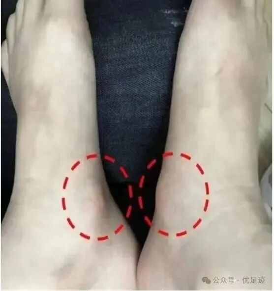 61