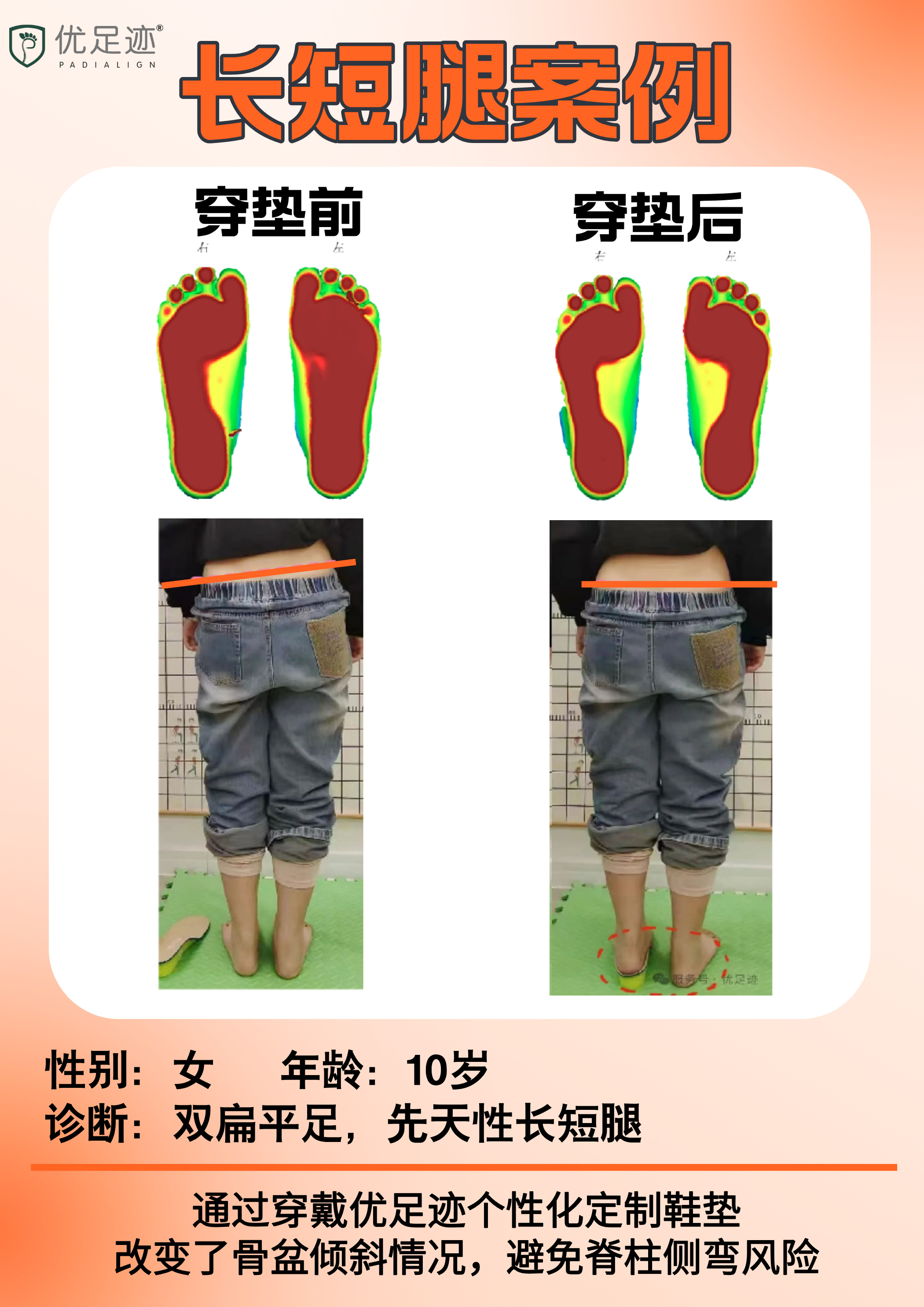 177062030657cab0